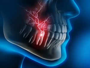 acute pain in a tooth requiring an emergency dentist located in Salem Oregon